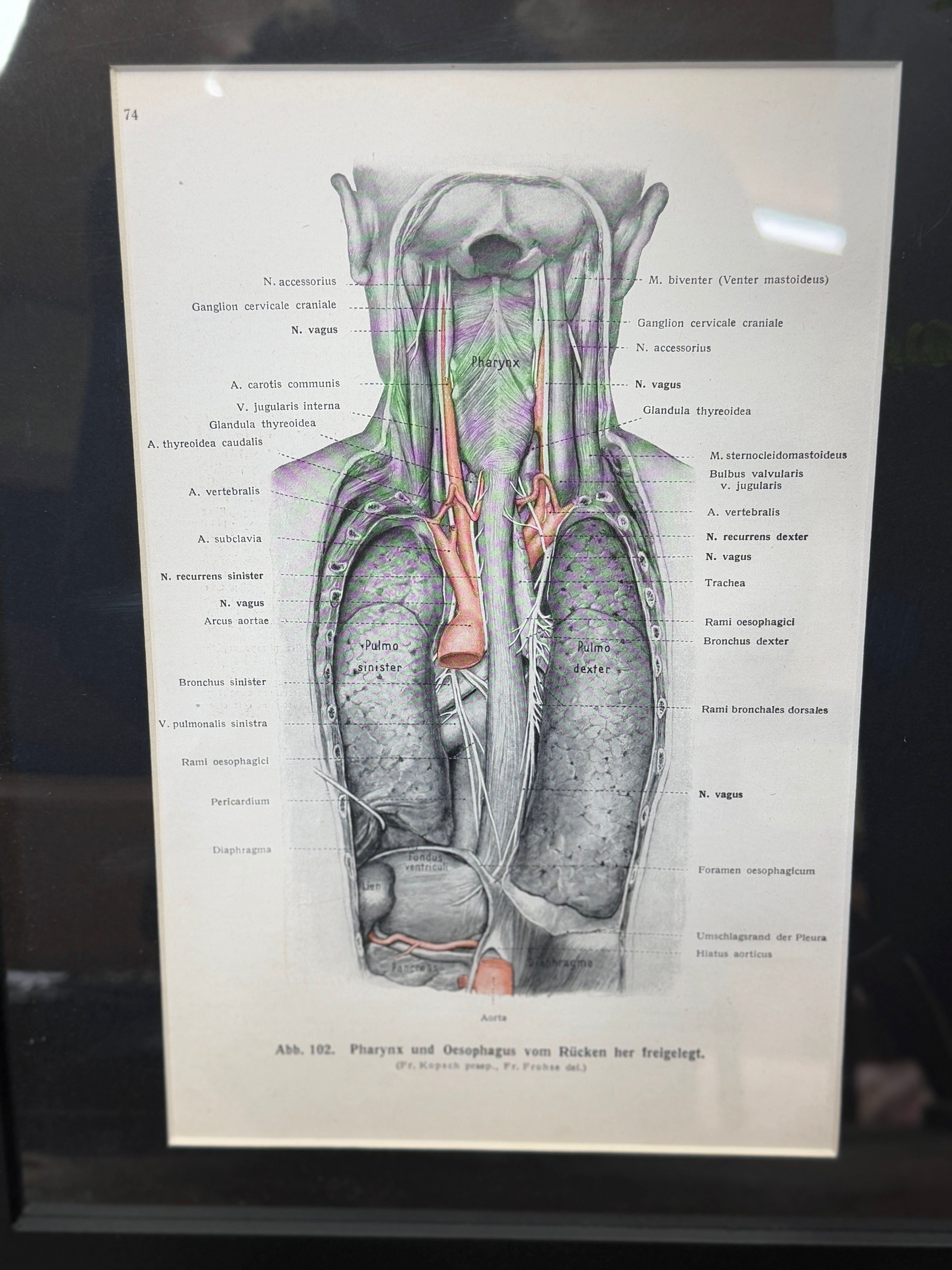 Framed Antique Anatomy Print 1920s Medical Book Plate Wall Art Picture G