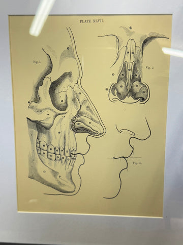 Victorian Anatomy Engraving – Antique Medical Print L