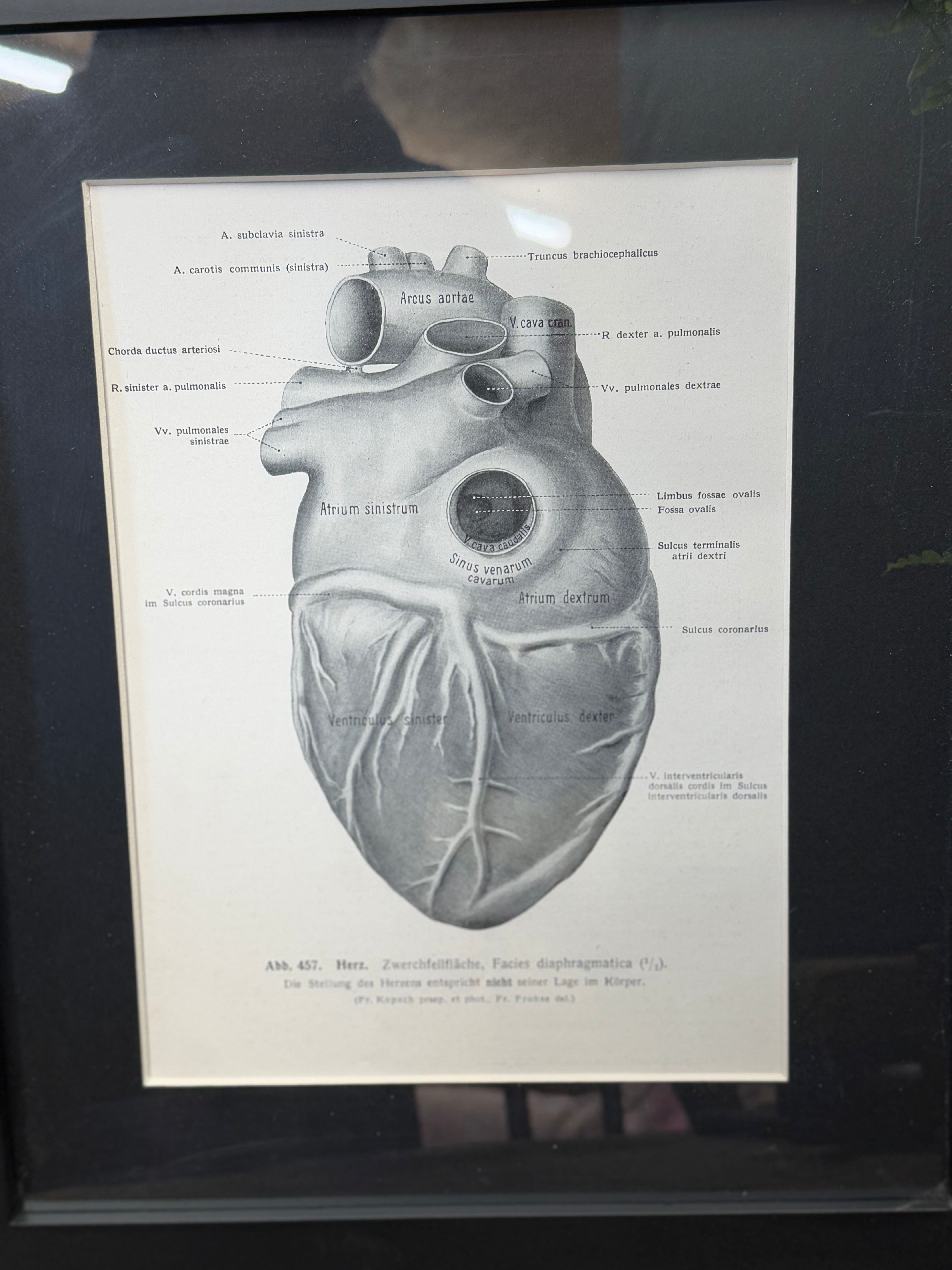 Framed Antique Anatomy Print 1920s Medical Book Plate Wall Art Picture T