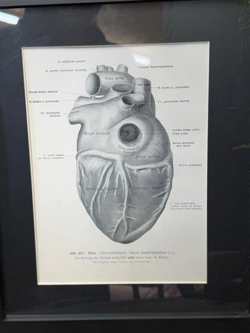 Framed Antique Anatomy Print 1920s Medical Book Plate Wall Art Picture T
