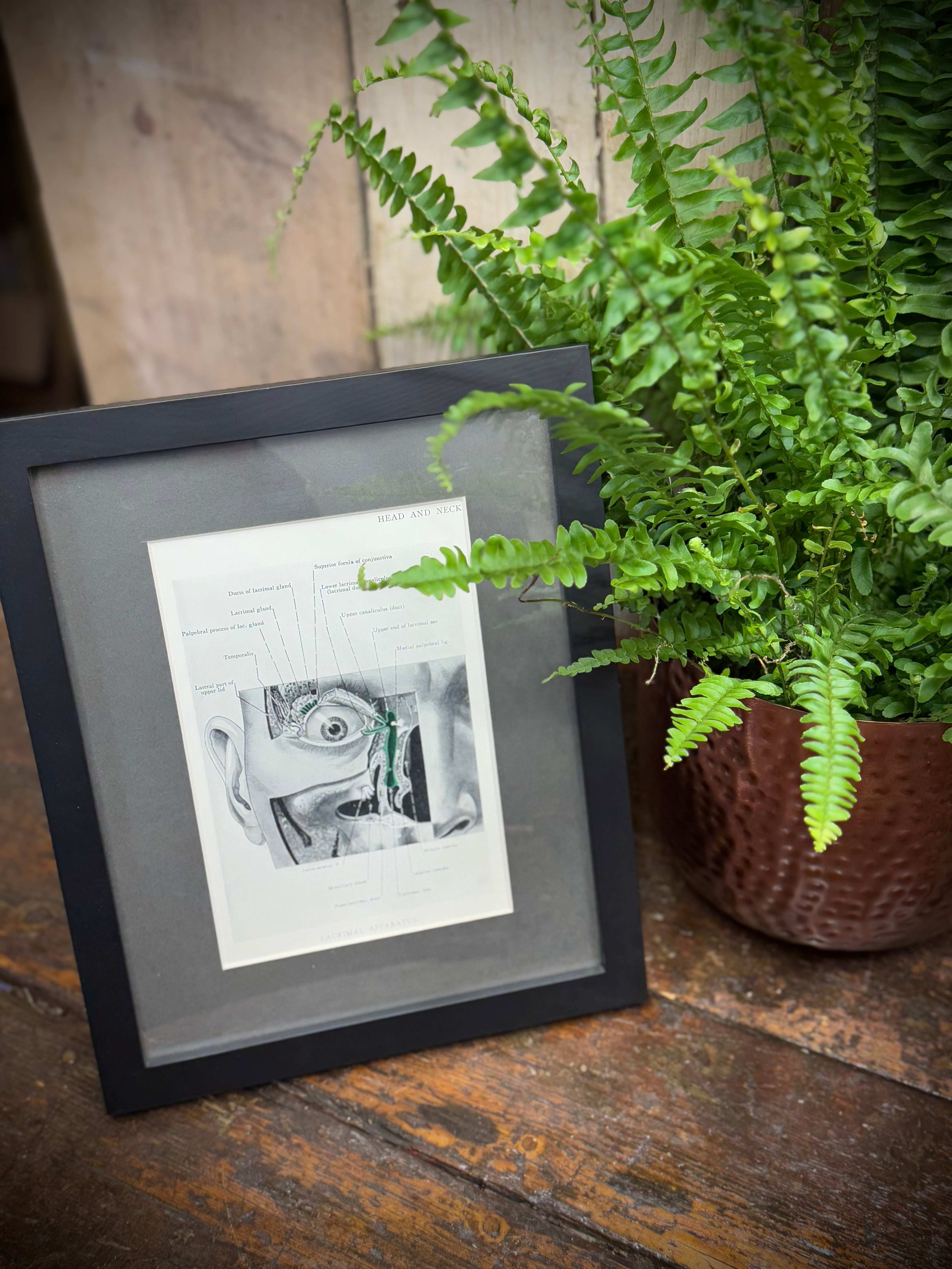 Black-framed 1920s medical book plate featuring detailed black-and-white anatomical face illustration with potted fern nearby