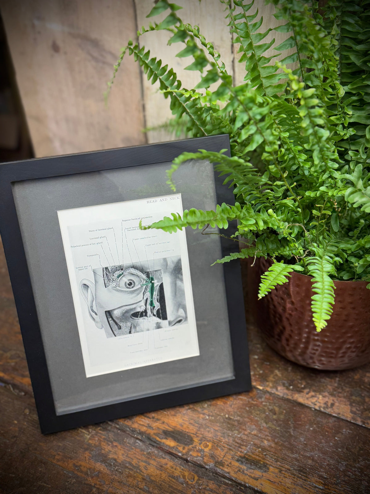 Black-framed 1920s medical book plate featuring detailed black-and-white anatomical face illustration with potted fern nearby