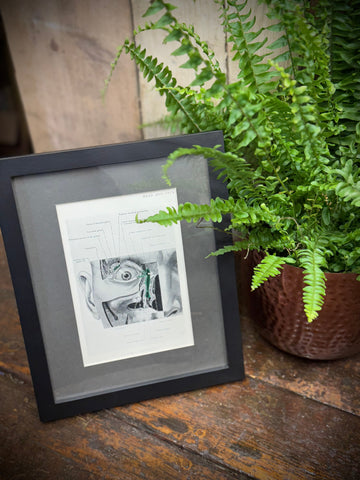 Black-framed 1920s medical book plate featuring detailed black-and-white anatomical face illustration with potted fern nearby