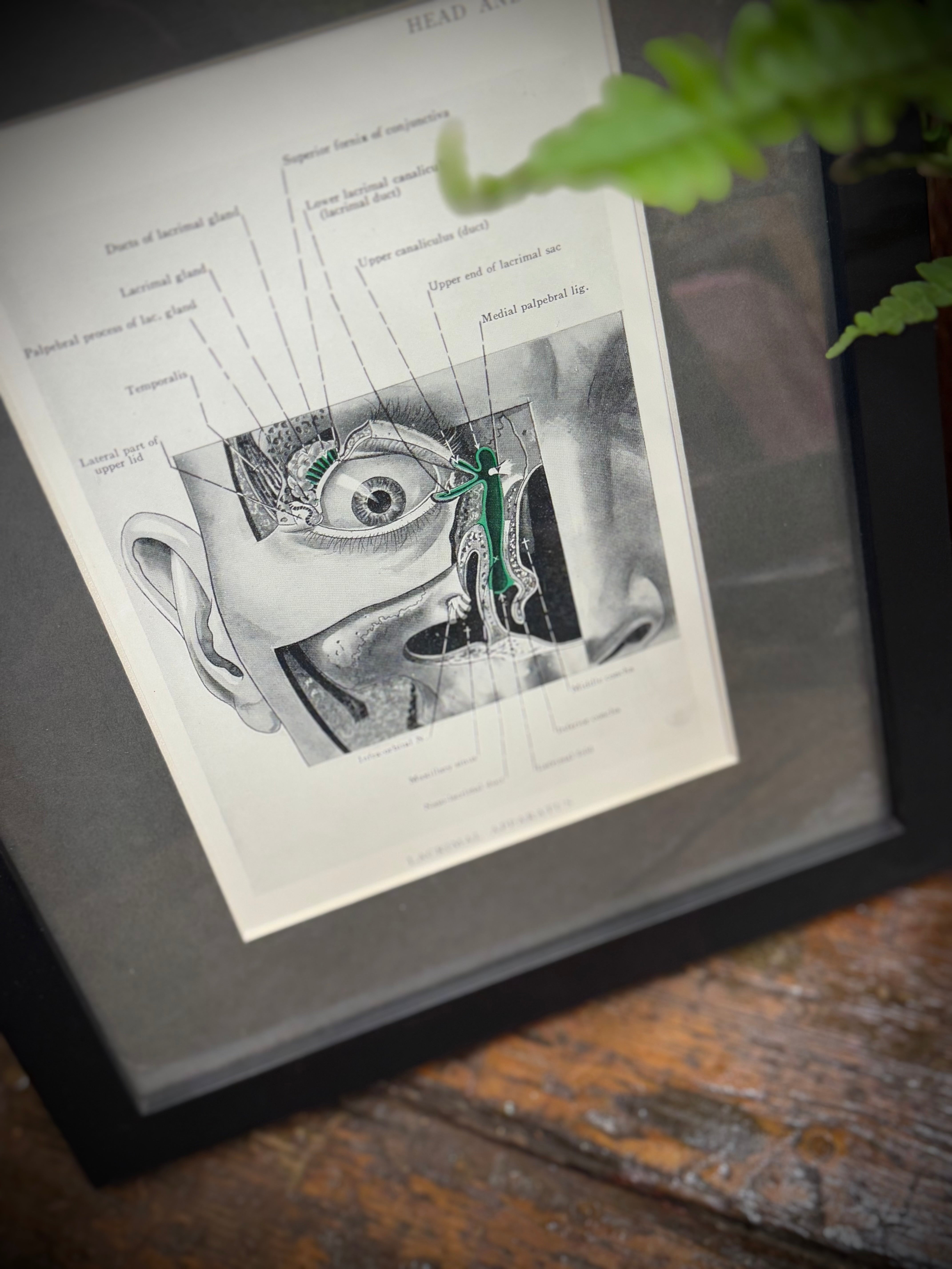 Black-framed anatomical print showing detailed eye and nasal cavity from a 1920s medical book plate wall art