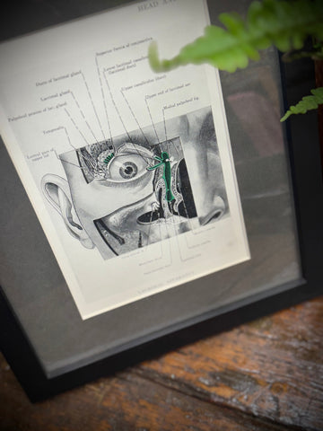 Black-framed anatomical print showing detailed eye and nasal cavity from a 1920s medical book plate wall art