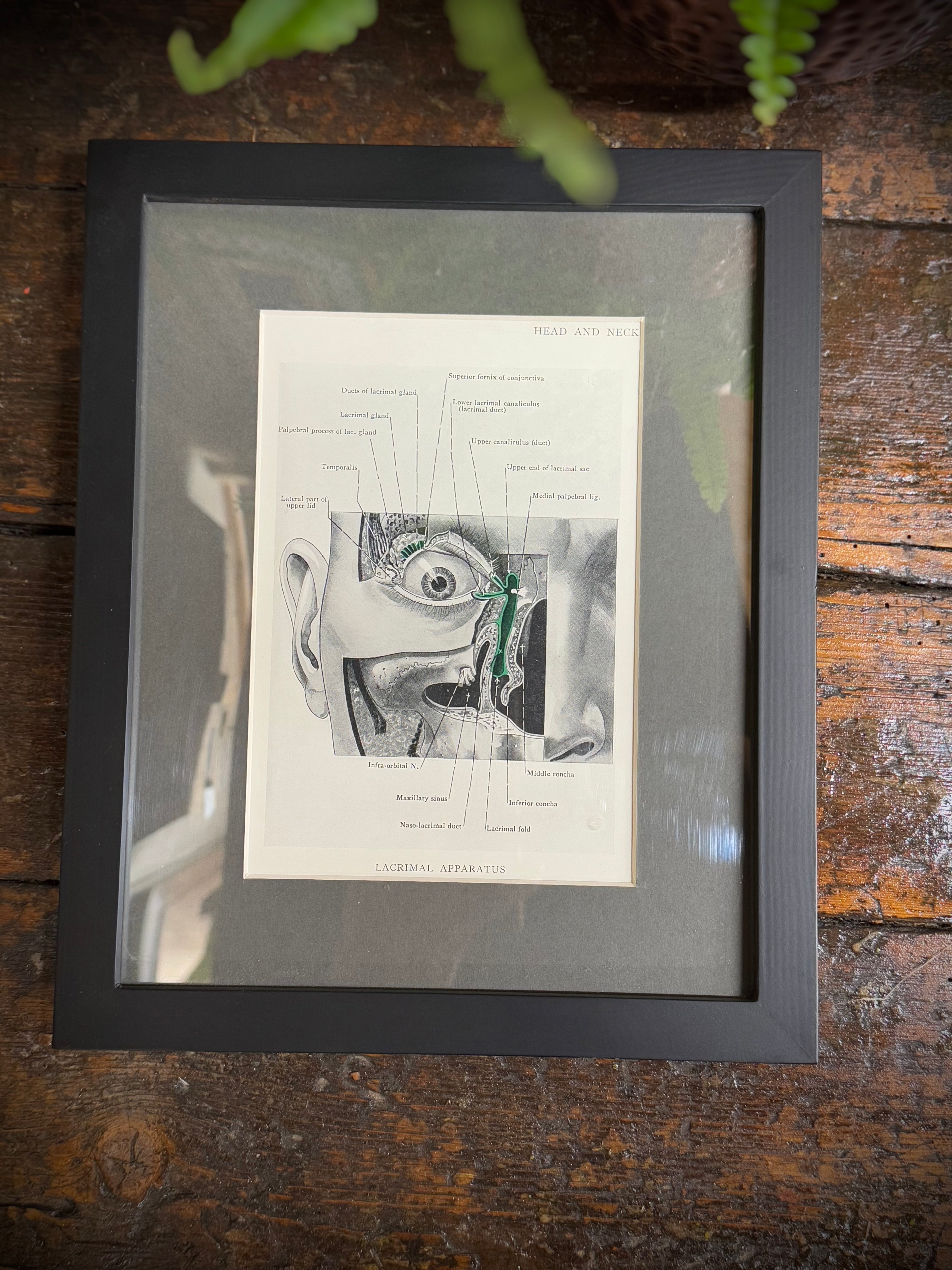 Black-framed anatomical print featuring labeled cross-section of head from a 1920s medical book plate wall art