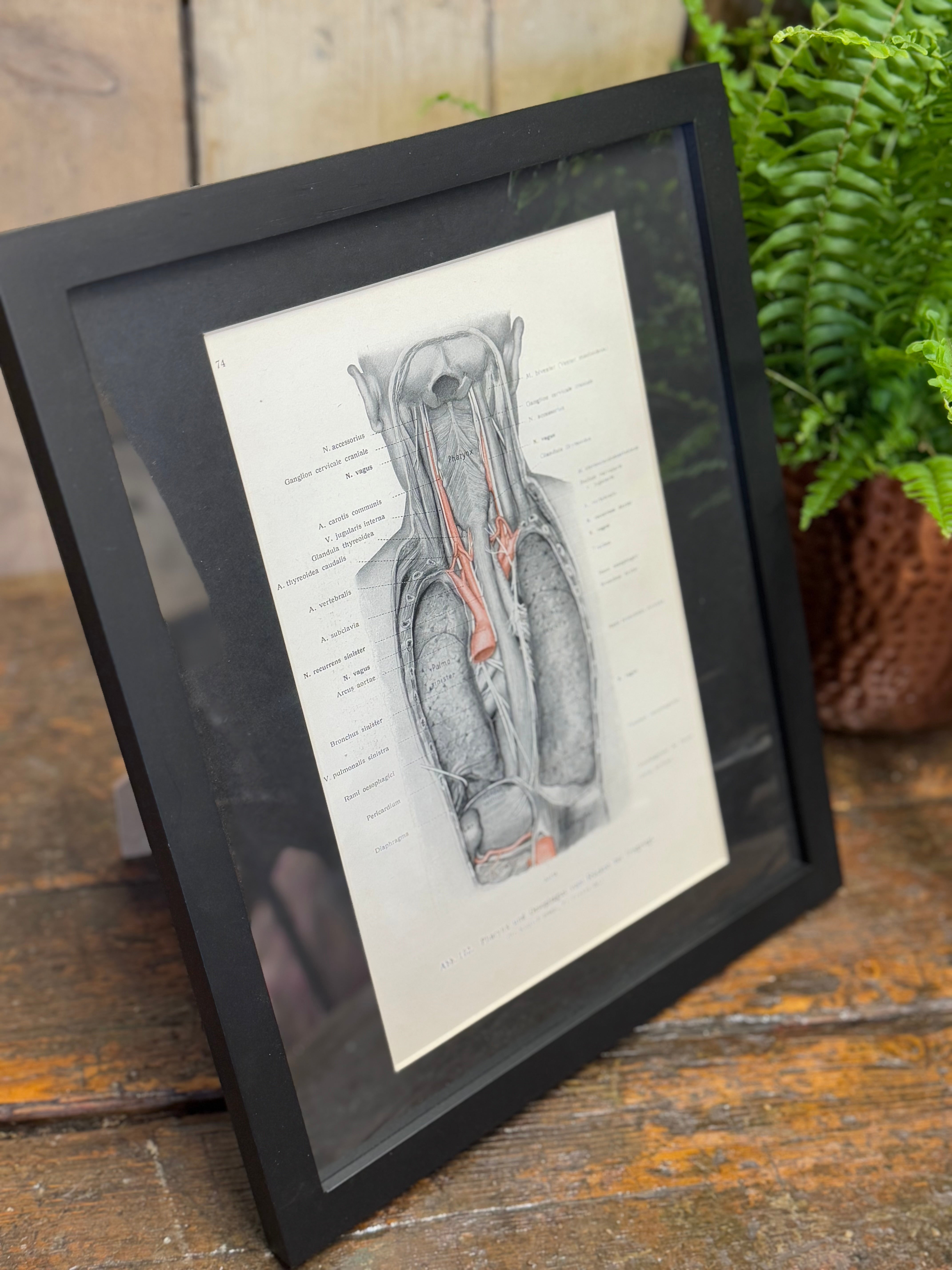 Black-framed 1920s medical book plate featuring gray anatomical neck and thoracic illustration with red vascular details