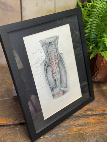 Black-framed 1920s medical book plate featuring gray anatomical neck and thoracic illustration with red vascular details