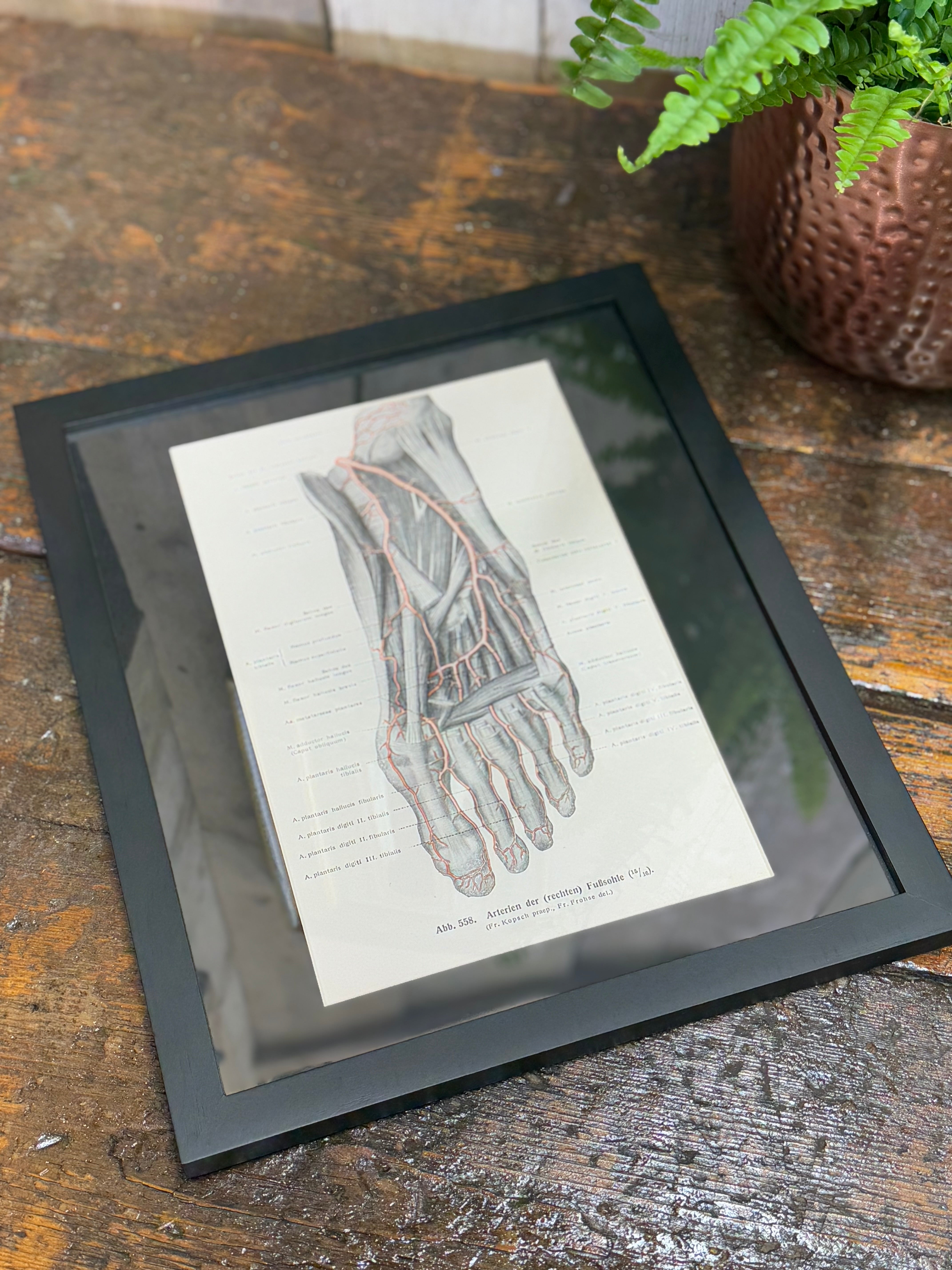 Black-framed 1920s medical book plate showing a human foot with pink vein and nerve details on aged paper wall art