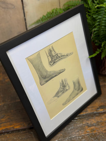 Black-framed victorian anatomy engraving showing pencil sketch of feet on aged yellow paper medical print