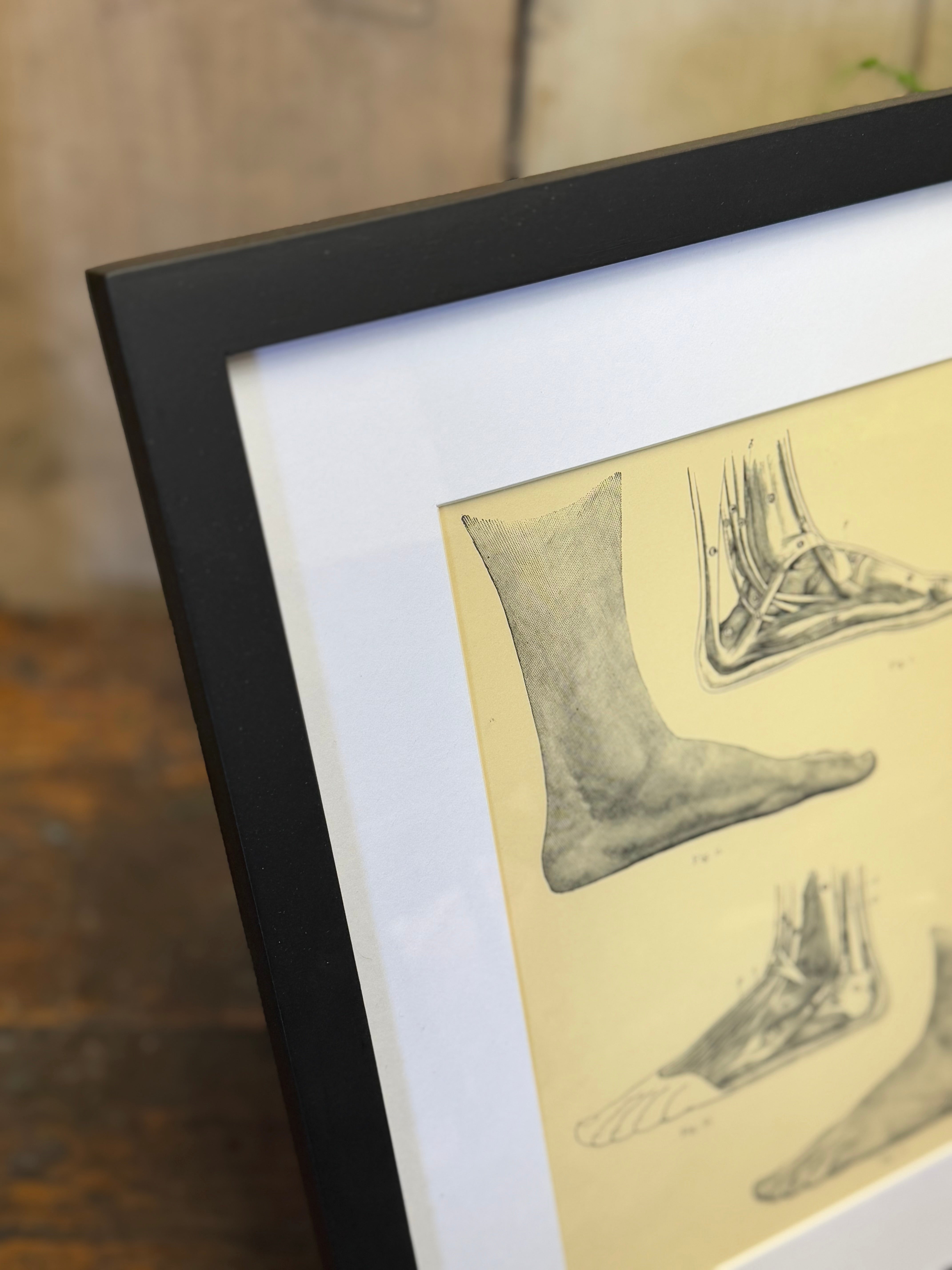 Black-framed victorian anatomy engraving of sepia toned feet illustration antique medical print m