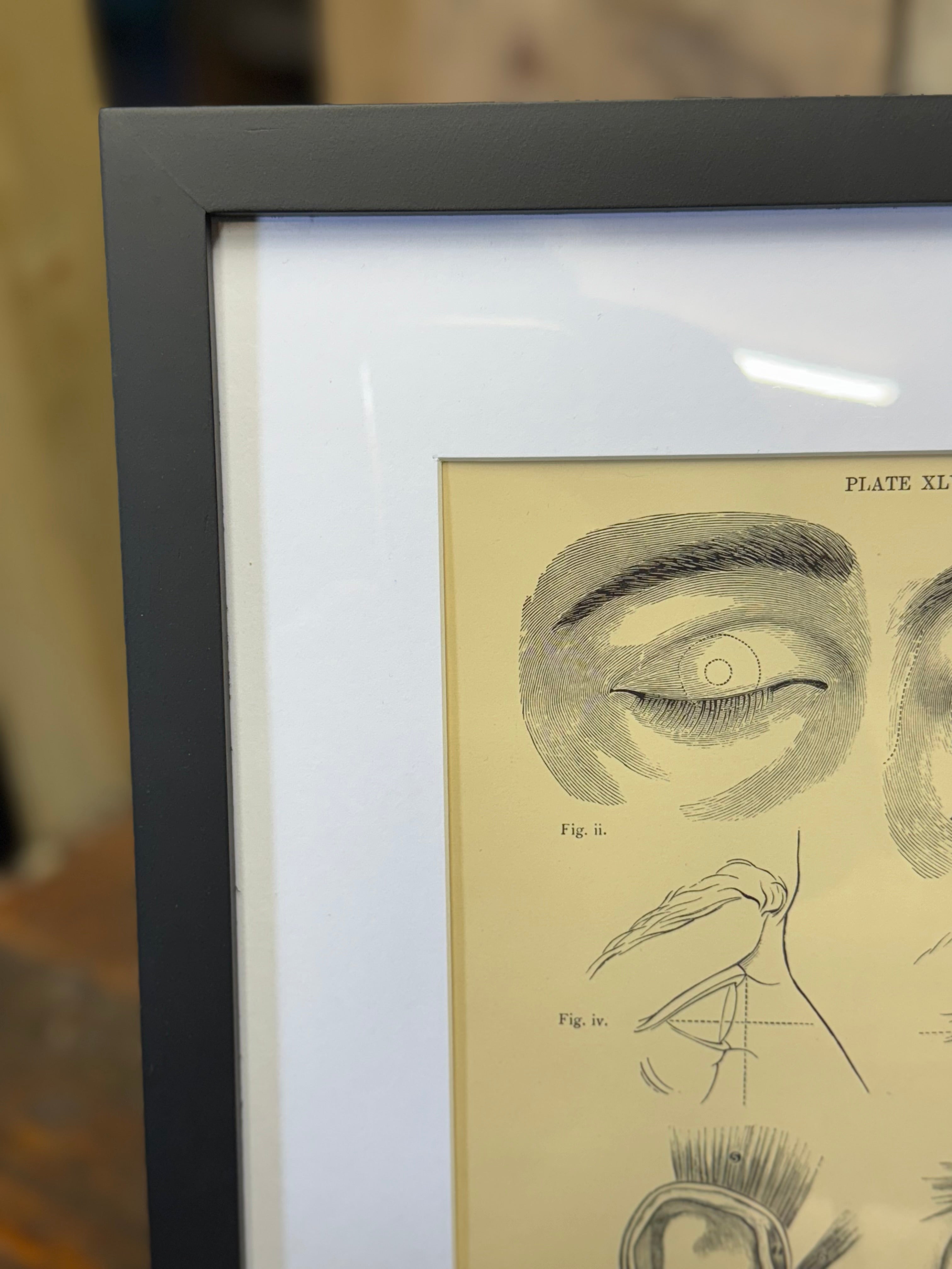 A framed victorian anatomy engraving featuring detailed black ink eye and facial drawings on aged pale yellow paper