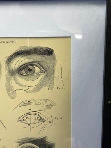 A detailed black and white anatomical engraving of an eye framed in a white mat from victorian anatomy print p