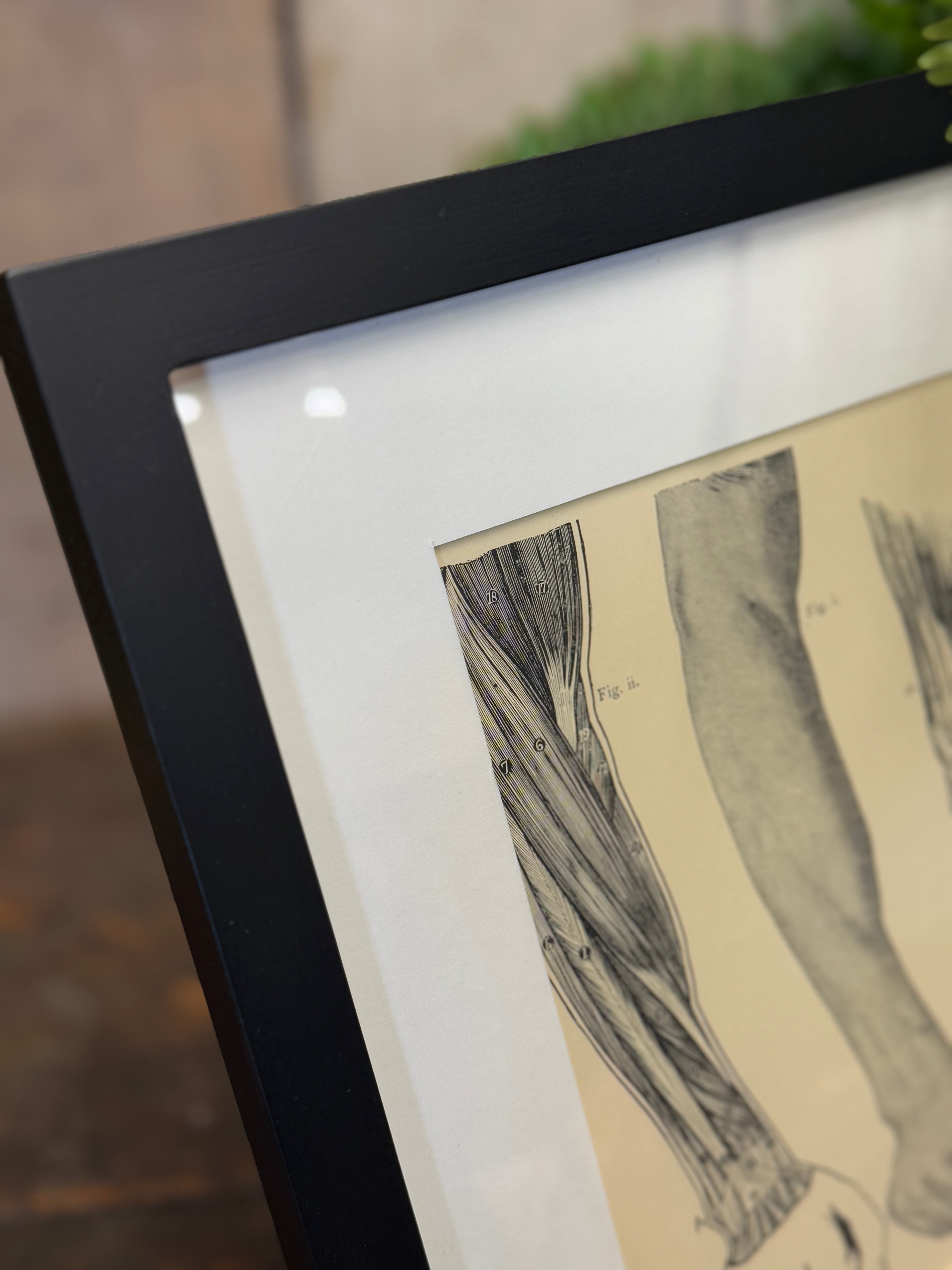 Black-framed victorian anatomy engraving showing leg muscles on aged cream paper for antique medical print decor