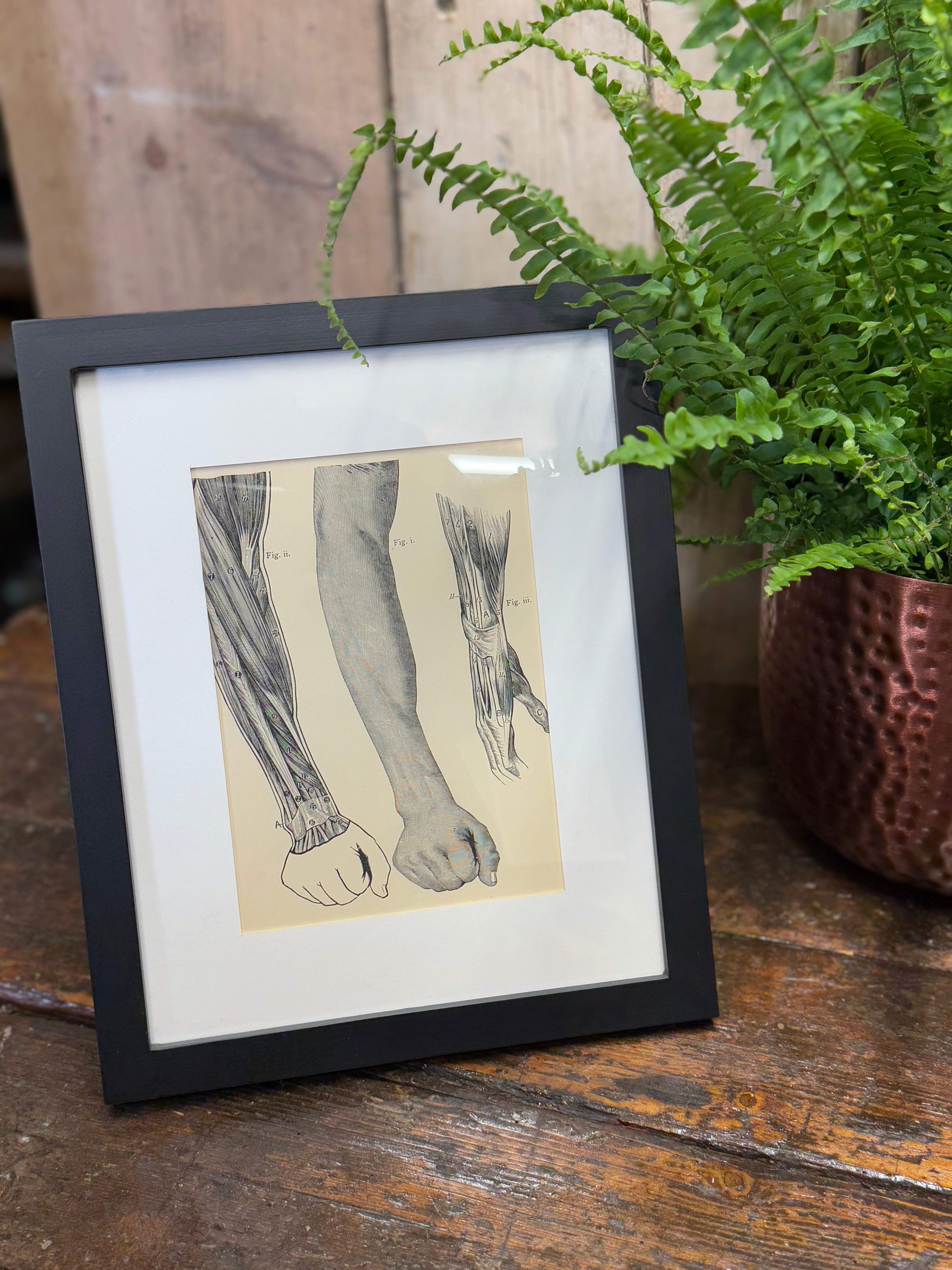 Black-framed Victorian anatomy engraving showing vintage-style print of human arm muscles in an antique medical illustration