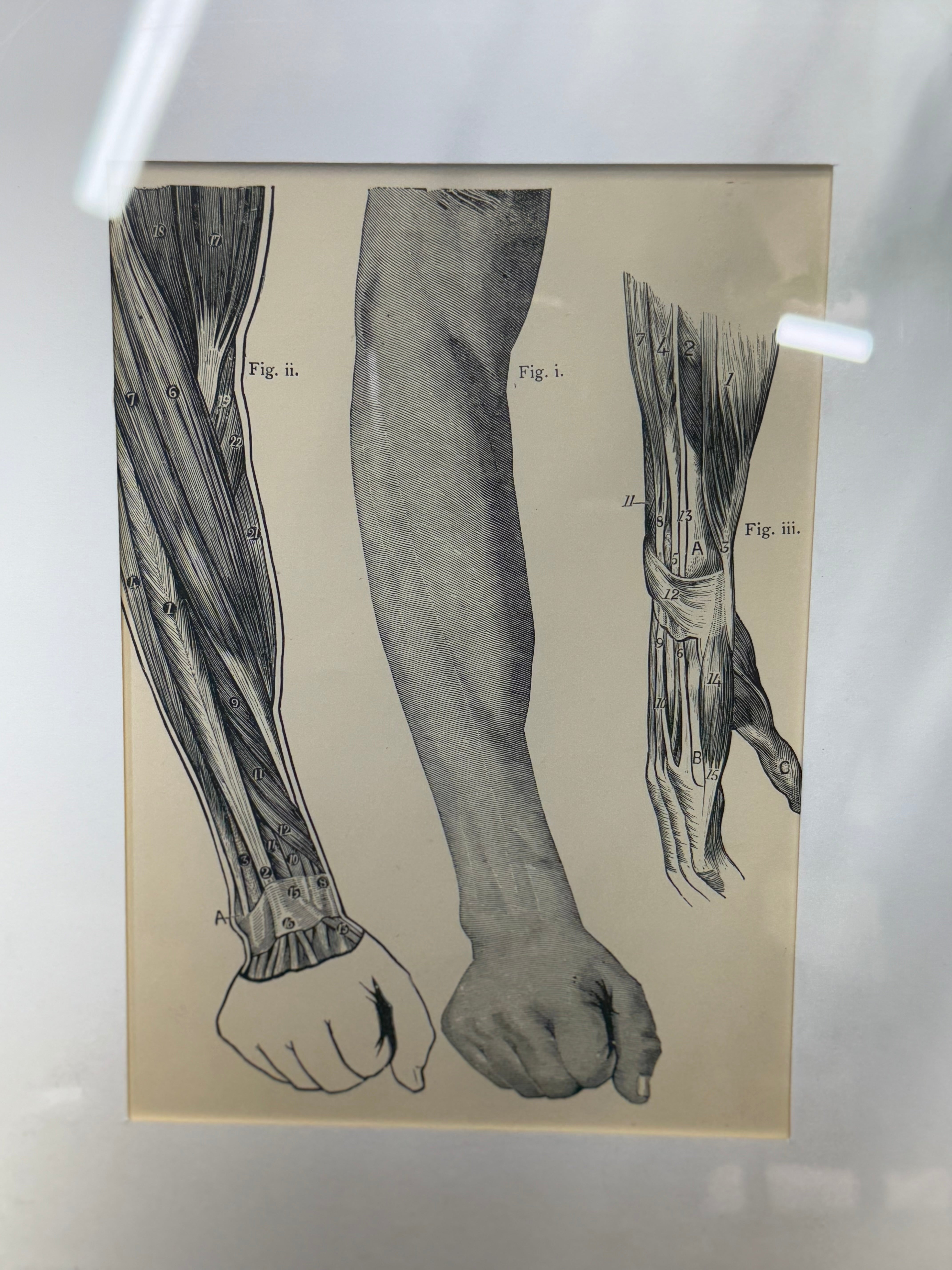 Framed victorian anatomy engraving showing detailed black and white human arm and hand muscle diagrams