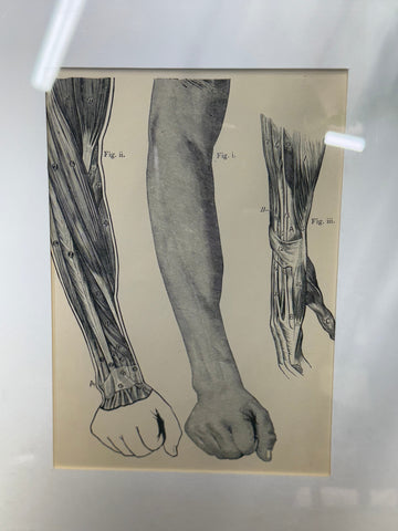 Framed victorian anatomy engraving showing detailed black and white human arm and hand muscle diagrams